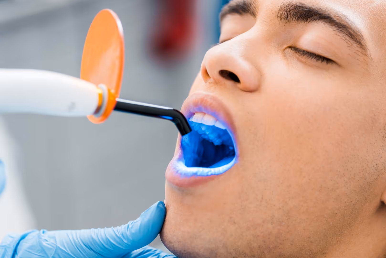 close up of african american man during bleaching procedure