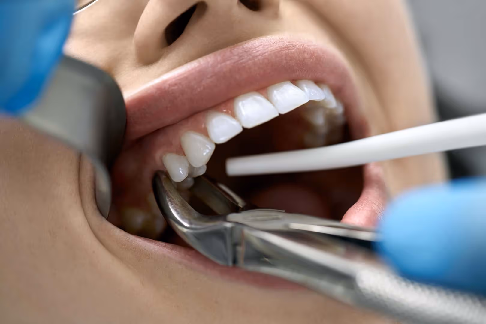 Pretty woman's teeth treatment in dental clinic